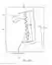 Fig. 44 - SURGICAL CLOSURE CONFIGURATIONS