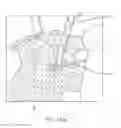 Fig. 53 - SURGICAL CLOSURE CONFIGURATIONS