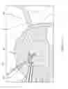 Fig. 55 - SURGICAL CLOSURE CONFIGURATIONS