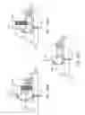Fig. 85 - SURGICAL CLOSURE CONFIGURATIONS