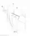 Fig. 43 - Tissue repair device
