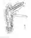 Fig. 07 - Surgical stapler with curved outer surface on anvil
