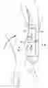 Fig. 01 - Apparatus and method for heart valve repair