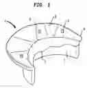 Fig. 02 - Apparatus and method for heart valve repair
