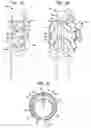 Fig. 03 - Apparatus and method for heart valve repair