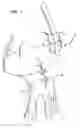 Fig. 07 - Apparatus and method for heart valve repair