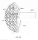 Fig. 19 - Fastener delivery system and related methods