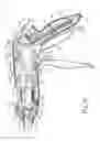 Fig. 07 - Surgical stapler with fixed jaw support pin