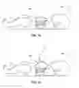 Fig. 02 - CURLED SUTURE DEVICE APPARATUS AND METHOD