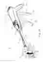 Fig. 02 - Method of applying staples in lower anterior bowel resection