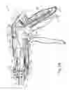 Fig. 07 - Method of applying staples in lower anterior bowel resection