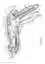 Fig. 08 - Method of applying staples in lower anterior bowel resection