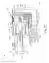 Fig. 15 - Method of applying staples in lower anterior bowel resection