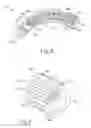 Fig. 17 - Method of applying staples in lower anterior bowel resection