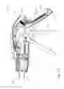Fig. 22 - Method of applying staples in lower anterior bowel resection