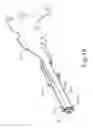 Fig. 24 - Method of applying staples in lower anterior bowel resection