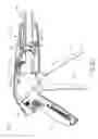 Fig. 29 - Method of applying staples in lower anterior bowel resection
