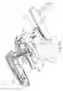 Fig. 32 - Method of applying staples in lower anterior bowel resection