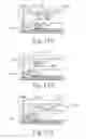 Fig. 34 - Method of applying staples in lower anterior bowel resection