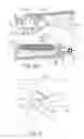 Fig. 37 - Method of applying staples in lower anterior bowel resection