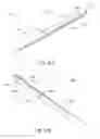Fig. 43 - Method of applying staples in lower anterior bowel resection