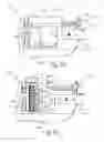 Fig. 55 - Method of applying staples in lower anterior bowel resection