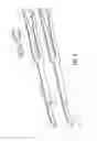 Fig. 06 - Surgical stapling apparatus