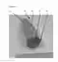 Fig. 04 - Introducer for a surgical stapler