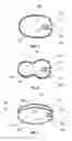 Fig. 04 - System and method for reshaping right heart