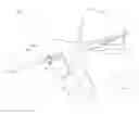 Fig. 01 - Drilling Assembly and a Method for Preparing Graft Socket for Ligament Reconstruction