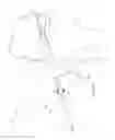 Fig. 09 - Drilling Assembly and a Method for Preparing Graft Socket for Ligament Reconstruction