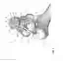 Fig. 02 - Hip resurfacing drill guide device