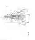 Fig. 04 - Hip resurfacing drill guide device