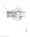 Fig. 07 - Hip resurfacing drill guide device