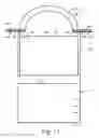 Fig. 05 - Lumpectomy Knife Set