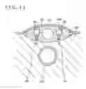 Fig. 12 - MEDICAL DEVICE AND METHOD