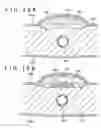 Fig. 19 - MEDICAL DEVICE AND METHOD