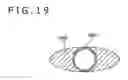 Fig. 20 - MEDICAL DEVICE AND METHOD