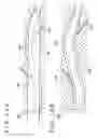 Fig. 17 - MEDICAL DEVICE AND METHOD