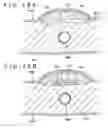 Fig. 19 - MEDICAL DEVICE AND METHOD