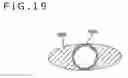 Fig. 20 - MEDICAL DEVICE AND METHOD