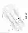 Fig. 37 - MEDICAL DEVICE AND METHOD