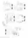 Fig. 47 - MEDICAL DEVICE AND METHOD