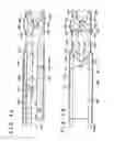 Fig. 05 - Medical device and method