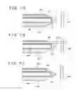 Fig. 08 - Medical device and method