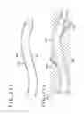 Fig. 18 - Medical device and method