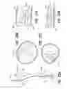 Fig. 21 - Medical device and method