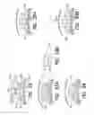 Fig. 44 - Medical device and method