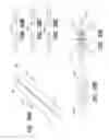 Fig. 46 - Medical device and method