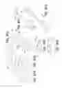 Fig. 49 - Medical device and method